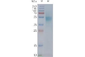 Human C-Nanodisc, Flag Tag on SDS-PAGE (CXCR1 蛋白)