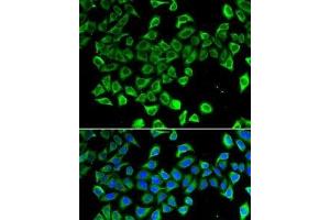 Immunofluorescence analysis of A-549 cells using LCN2 Polyclonal Antibody (Lipocalin 2 抗体)