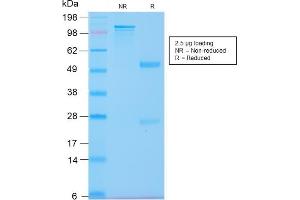 SDS-PAGE (SDS) image for anti-Keratin 20 (KRT20) (AA 196-323) antibody (ABIN6940352)