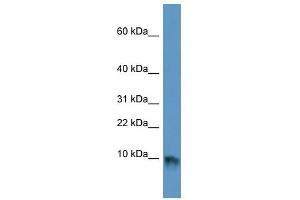 EGF antibody used at 1 ug/ml to detect target protein. (EGF 抗体)