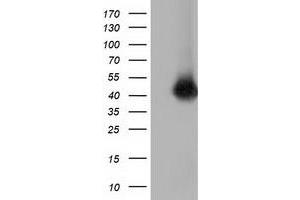 HEK293T cells were transfected with the pCMV6-ENTRY control (Left lane) or pCMV6-ENTRY CD80 (Right lane) cDNA for 48 hrs and lysed. (CD80 抗体)