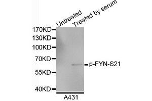 Western blot analysis of extracts of A4731 cells, using Phospho-FYN-S21 antibody. (FYN 抗体  (pSer21))