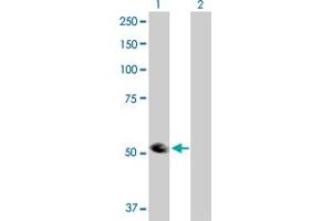Western Blot analysis of TRIP6 expression in transfected 293T cell line by TRIP6 MaxPab polyclonal antibody. (TRIP6 抗体  (AA 1-476))