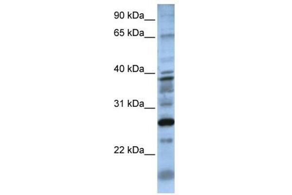 DOLPP1 抗体  (N-Term)