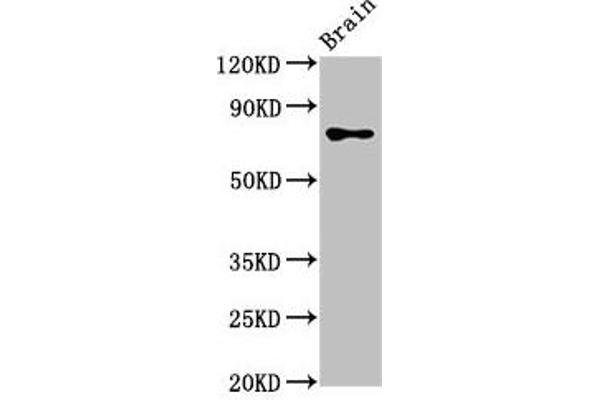 CASC1 抗体  (AA 1-300)