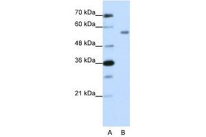 Western Blot showing ZNF497 antibody used at a concentration of 1-2 ug/ml to detect its target protein. (ZNF497 抗体  (N-Term))