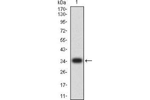 Western blot analysis using CD5 mAb against human CD5 (AA: 403-495) recombinant protein. (CD5 抗体  (AA 403-495))