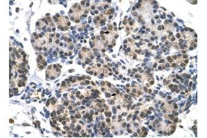 DHX9 antibody was used for immunohistochemistry at a concentration of 4-8 ug/ml to stain Epithelial cells of pancreatic acinus (arrows) in Human Pancreas. (DHX9 抗体)