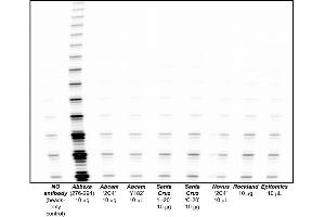 Antibodies and their commercial vendor are described, based on immunoprecipitation of telomerase from HEK-293 tumour cell lysates, followed by a 1 hr elution in the presence of antigenic peptide, if available. (hTERT 抗体)