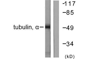 Western blot analysis of extracts from NIH/3T3 cells, using Tubulin alpha antibody. (alpha Tubulin 抗体  (C-Term))