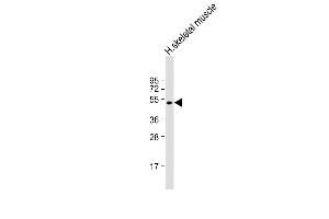 Anti-ZDHHC9 Antibody (C-term) at 1:2000 dilution + human skeletal muscle lysate Lysates/proteins at 20 μg per lane. (ZDHHC9 抗体  (C-Term))