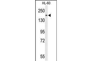 Western blot analysis of PLCB1 Antibody in HL-60 cell line lysates (35ug/lane) (Phospholipase C beta 1 抗体  (C-Term))