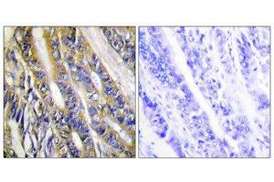 Immunohistochemistry (IHC) image for anti-Diacylglycerol Kinase, eta (DGKH) (Internal Region) antibody (ABIN1849746) (DGKH 抗体  (Internal Region))