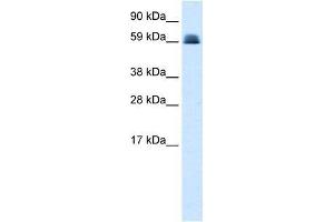 Western Blot showing ZNF499 antibody used at a concentration of 1-2 ug/ml to detect its target protein. (ZBTB45 抗体  (Middle Region))