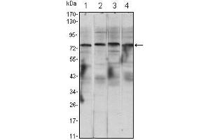 Western Blot showing CHUK antibody used against Raji (1), Jurkat (2), THP-1 (3) and K562 (4) cell lysate. (IKK alpha 抗体)