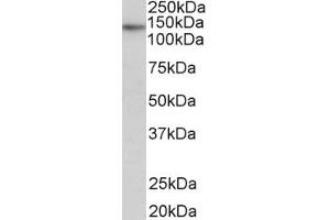 Western Blotting (WB) image for anti-Telomerase Reverse Transcriptase (TERT) (AA 597-611) antibody (ABIN1104625) (TERT 抗体  (AA 597-611))