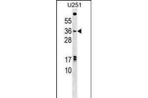 NKX3-1 Antibody (C-term) (ABIN1536752 and ABIN2848824) western blot analysis in  cell line lysates (35 μg/lane). (NKX3-1 抗体  (C-Term))