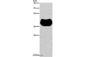 Western blot analysis of Human fetal muscle tissue, using HRH2 Polyclonal Antibody at dilution of 1:300 (HRH2 抗体)