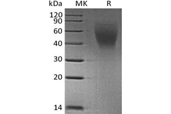 MUC16 Protein (His tag)