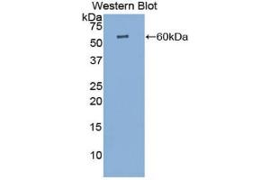 Western blot analysis of the recombinant protein. (Cathepsin K 抗体  (AA 71-319))