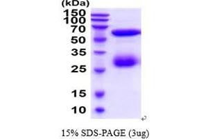 CHI3L1 Protein (AA 22-383) (His tag)