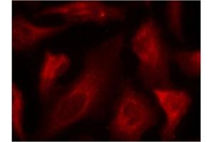 Image no. 2 for anti-Tumor Protein P53 (TP53) (pSer33) antibody (ABIN319215) (p53 抗体  (pSer33))