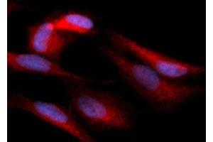 Immunofluorescence (IF) image for anti-Hexokinase 1 (HK1) (AA 1-917) antibody (PE) (ABIN5567562) (Hexokinase 1 抗体  (AA 1-917) (PE))