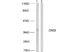Western blot analysis of extracts from HeLa cells treated with UV, using CREB (Ab-129/133) antibody (#B7053). (CREB1 抗体  (Ser129, Ser133))