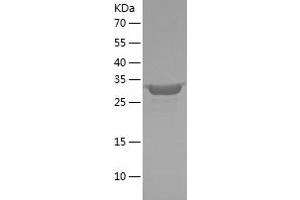Western Blotting (WB) image for DnaJ (Hsp40) Homolog, Subfamily B, Member 2 (DNAJB2) (AA 1-277) protein (His tag) (ABIN7285763) (DNAJB2 Protein (AA 1-277) (His tag))