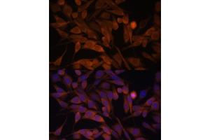 Immunofluorescence analysis of HeLa cells using CACYBP antibody  at dilution of 1:100. (CACYBP 抗体  (AA 1-228))