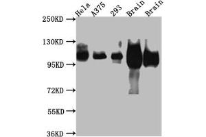 Western Blot Positive WB detected in: Hela whole cell lysate, A375 whole cell lysate, HEK293 whole cell lysate, Rat Brain whole cell lysate, Mouse Brain whole cell lysate All lanes: Amyloid beta A4 antibody at 1:1000 Secondary Goat polyclonal to rabbit IgG at 1/50000 dilution Predicted band size: 87, 35, 77, 79, 79, 81, 83, 85, 86, 73, 85 kDa Observed band size: 100 kDa (Recombinant APP 抗体)