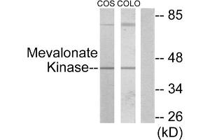 Western blot analysis of extracts from COS-7 cells and COLO205 cells, using Mevalonate Kinase antibody. (MVK 抗体  (Internal Region))