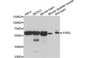 Western blot analysis of extracts of various cell lines, using YARS antibody (ABIN5974115) at 1/1000 dilution. (YARS 抗体)
