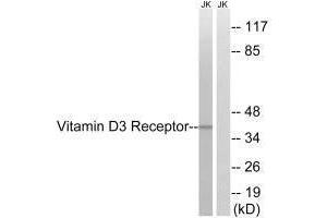 Western blot analysis of extracts from Jurkat cells, using Vitamin D3 Receptor (Ab-51) antibody. (Vitamin D Receptor 抗体  (Ser51))