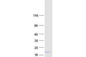 Validation with Western Blot (TXNL4B Protein (Transcript Variant 1) (Myc-DYKDDDDK Tag))