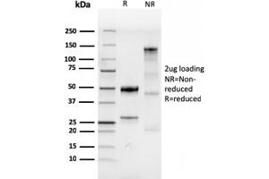 SDS-PAGE Analysis Purified CDX2 Recombinant Rabbit Monoclonal Antibody (CDX2/4394R). (Recombinant CDX2 抗体)