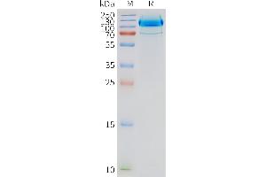 Human -Nanodisc, Flag Tag on SDS-PAGE (GRM2 蛋白)