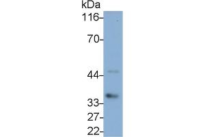 Detection of IL1b in Canine Pancreas lysate using Polyclonal Antibody to Interleukin 1 Beta (IL1b) (IL-1 beta 抗体  (AA 103-260))