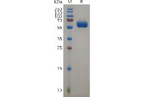 Human F Protein, hFc Tag on SDS-PAGE under reducing condition. (FOLR2 Protein (AA 17-228) (Fc Tag))