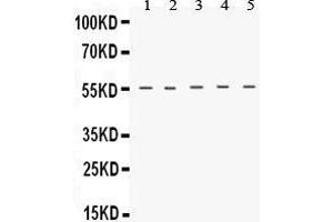 Western Blotting (WB) image for anti-Tachykinin Receptor 1 (TACR1) (AA 264-291), (C-Term) antibody (ABIN3043942) (TACR1 抗体  (C-Term))