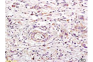 Immunohistochemistry (IHC) image for anti-Angiotensin I Converting Enzyme 2 (ACE2) (AA 601-700) antibody (ABIN730798) (ACE2 抗体  (AA 601-700))