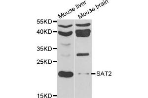 Western blot analysis of extracts of various cell lines, using SAT2 antibody. (SAT2 抗体)