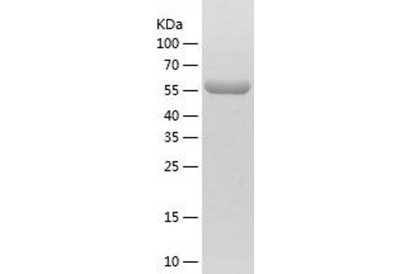 HSF1 Protein (AA 2-529) (His tag)