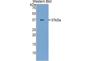 Detection of Recombinant zAP70, Mouse using Polyclonal Antibody to Zeta Chain Associated Protein Kinase 70 kDa (zAP70) (ZAP70 抗体  (AA 270-560))