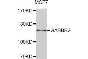 Western blot analysis of extracts of MCF-7 cells, using GABBR2 antibody (ABIN5975417) at 1/1000 dilution. (GABBR2 抗体)