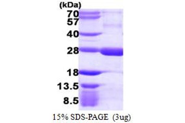 RGS5 Protein (AA 1-181) (His tag)