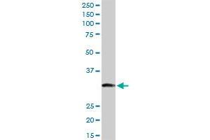 ITPK1 MaxPab rabbit polyclonal antibody. (ITPK1 抗体  (AA 1-314))