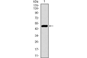 Western Blotting (WB) image for anti-EGFR Mutant (AA 693-893), (Mutant) antibody (ABIN1845729) (EGFR Mutant (AA 693-893), (Mutant) 抗体)