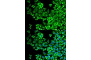 Immunofluorescence analysis of A549 cell using HCK antibody. (HCK 抗体  (AA 1-220))