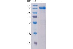 Human Protein, hFc Tag on SDS-PAGE under reducing condition. (PTK7 Protein (AA 31-704) (Fc Tag))